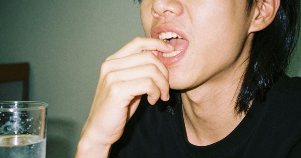 Common Causes of Overbite