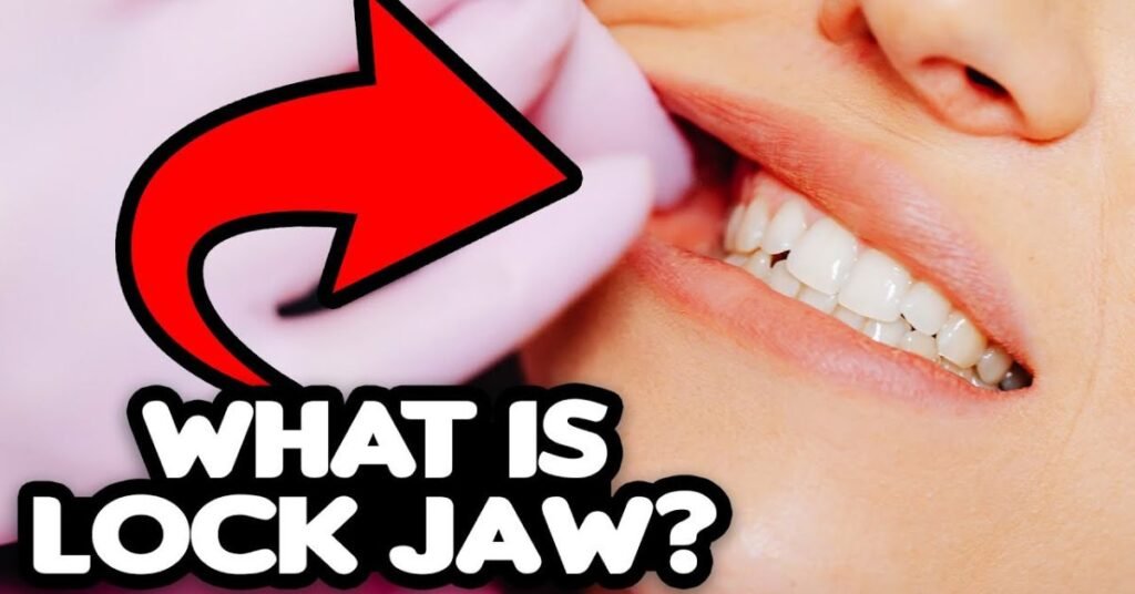 Warning Signs of locked jaw
