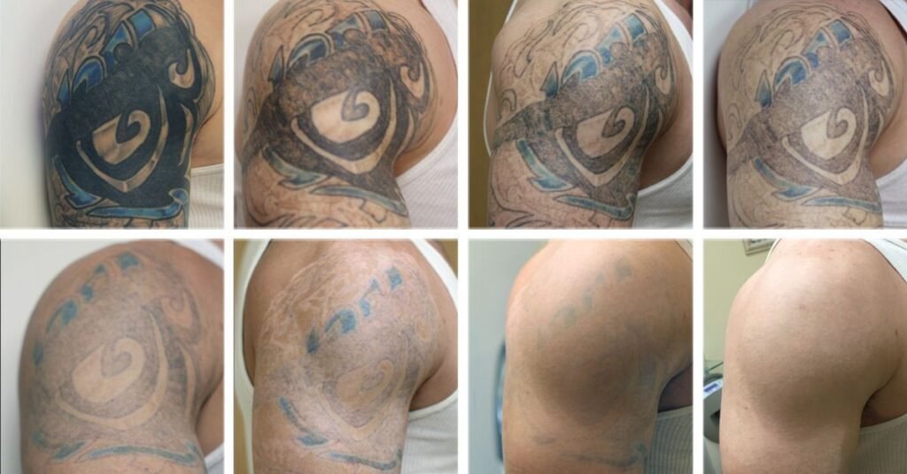 How Long Does a Tattoo Take to Heal